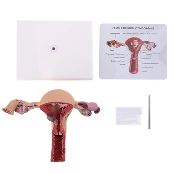 Umane De Sex Feminin Uter Ovar Disecție Patologie Model De Predare Biologie